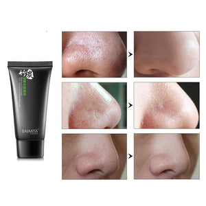 Facial Blackhead Remover